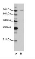 PRPF3 Antibody - A: Marker, B: HepG2 Cell Lysate.  This image was taken for the unconjugated form of this product. Other forms have not been tested.