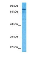PRPF3 Antibody - Western blot of PRPF3 Antibody with human MCF7 Whole Cell lysate.  This image was taken for the unconjugated form of this product. Other forms have not been tested.