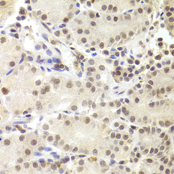 PRPF3 Antibody - Immunohistochemistry of paraffin-embedded Human gastric tissue.