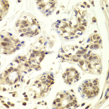 PRPF3 Antibody - Immunohistochemistry of paraffin-embedded Human mammary gland tissue.