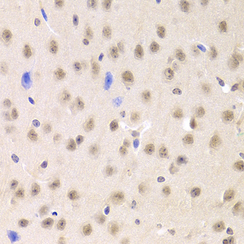PRPF3 Antibody - Immunohistochemistry of paraffin-embedded Mouse brain tissue.