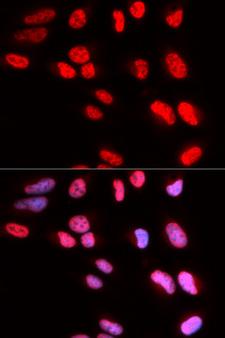 PRPF3 Antibody - Immunofluorescence analysis of U20S cells.