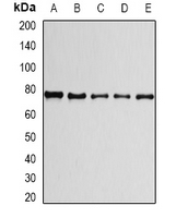 PRPF3 Antibody - Western blot analysis of PRPF3 expression in A549 (A); HepG2 (B); THP1 (C); mouse spleen (D); mouse testis (E) whole cell lysates.