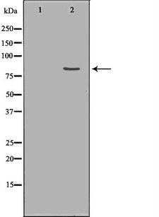 PRPF3 Antibody - Western blot analysis of HepG2 whole cells lysates using PRPF3 antibody. The lane on the left is treated with the antigen-specific peptide.