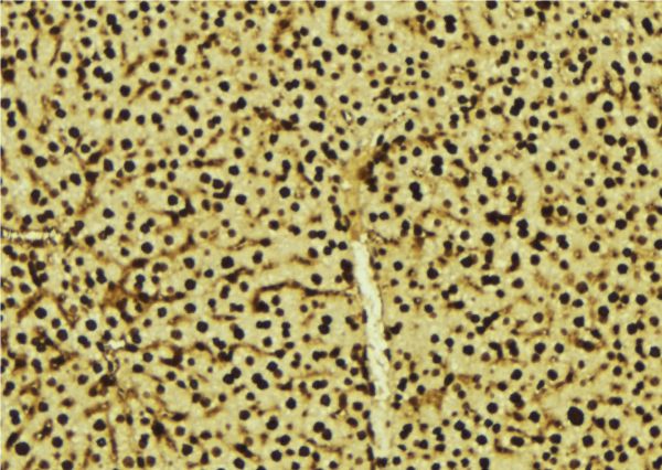 PRPF3 Antibody - 1:100 staining mouse liver tissue by IHC-P. The sample was formaldehyde fixed and a heat mediated antigen retrieval step in citrate buffer was performed. The sample was then blocked and incubated with the antibody for 1.5 hours at 22°C. An HRP conjugated goat anti-rabbit antibody was used as the secondary.