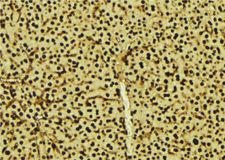 PRPF3 Antibody - 1:100 staining mouse liver tissue by IHC-P. The sample was formaldehyde fixed and a heat mediated antigen retrieval step in citrate buffer was performed. The sample was then blocked and incubated with the antibody for 1.5 hours at 22°C. An HRP conjugated goat anti-rabbit antibody was used as the secondary.