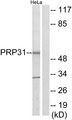 PRPF31 Antibody - Western blot analysis of lysates from HeLa cells, using PRP31 Antibody. The lane on the right is blocked with the synthesized peptide.