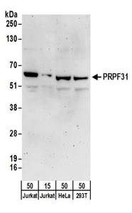 PRPF31 Antibody - Detection of Human PRPF31 by Western Blot. Samples: Whole cell lysate from Jurkat (15 and 50 ug), HeLa (50 ug), and 293T (50 ug) cells. Antibodies: Affinity purified rabbit anti-PRPF31 antibody used for WB at 0.1 ug/ml. Detection: Chemiluminescence with an exposure time of 3 minutes.
