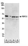 PRPF31 Antibody - Detection of Human PRPF31 by Western Blot. Samples: Whole cell lysate from Jurkat (15 and 50 ug), HeLa (50 ug), and 293T (50 ug) cells. Antibodies: Affinity purified rabbit anti-PRPF31 antibody used for WB at 0.1 ug/ml. Detection: Chemiluminescence with an exposure time of 3 minutes.