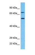 PRPF31 Antibody - Western blot of PRP31 Antibody with human Jurkat Whole Cell lysate.  This image was taken for the unconjugated form of this product. Other forms have not been tested.