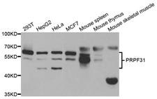PRPF31 Antibody - Western blot analysis of extracts of various cell lines.