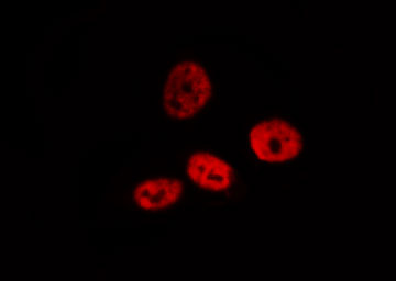 PRPF31 Antibody - Staining HeLa cells by IF/ICC. The samples were fixed with PFA and permeabilized in 0.1% Triton X-100, then blocked in 10% serum for 45 min at 25°C. The primary antibody was diluted at 1:200 and incubated with the sample for 1 hour at 37°C. An Alexa Fluor 594 conjugated goat anti-rabbit IgG (H+L) Ab, diluted at 1/600, was used as the secondary antibody.
