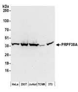 PRPF38A Antibody - Detection of human and mouse PRPF38A by western blot. Samples: Whole cell lysate (50 µg) from HeLa, HEK293T, Jurkat, mouse TCMK-1, and mouse NIH 3T3 cells prepared using NETN lysis buffer. Antibodies: Affinity purified rabbit anti-PRPF38A antibody used for WB at 0.1 µg/ml. Detection: Chemiluminescence with an exposure time of 30 seconds.