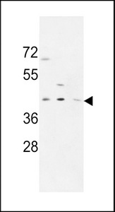 PRPF38A Antibody - PR38A Antibody western blot of MDA-MB231,CEM,HL-60 cell line lysates (35 ug/lane). The PR38A antibody detected the PR38A protein (arrow).