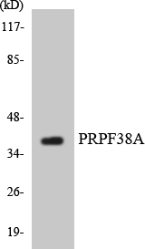 PRPF38A Antibody - Western blot analysis of the lysates from HUVECcells using PRPF38A antibody.