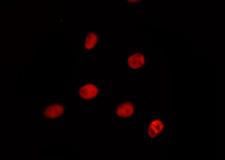 PRPF38A Antibody - Staining HeLa cells by IF/ICC. The samples were fixed with PFA and permeabilized in 0.1% Triton X-100, then blocked in 10% serum for 45 min at 25°C. The primary antibody was diluted at 1:200 and incubated with the sample for 1 hour at 37°C. An Alexa Fluor 594 conjugated goat anti-rabbit IgG (H+L) Ab, diluted at 1/600, was used as the secondary antibody.