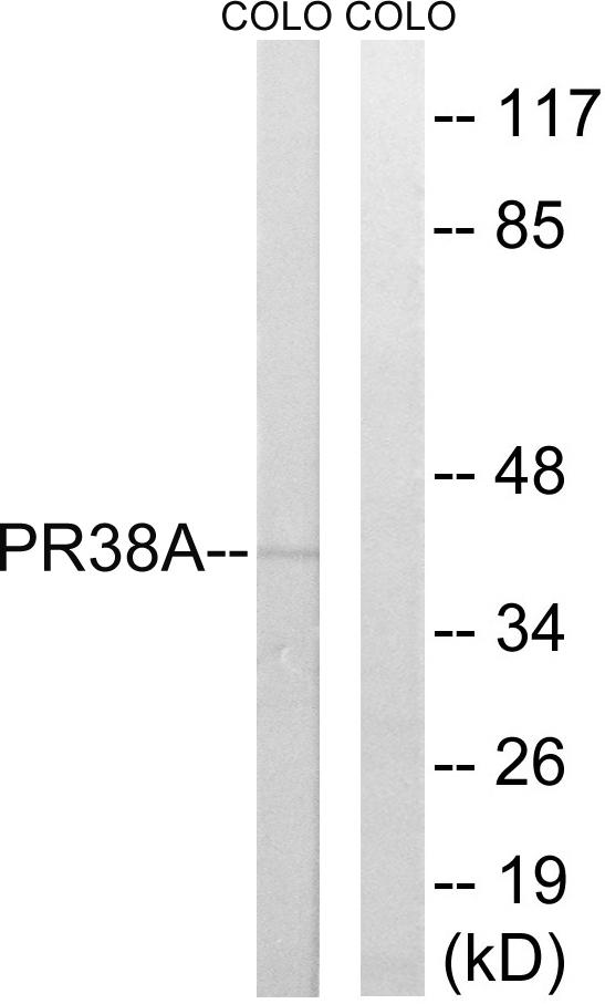 PRPF38A Antibody - Western blot analysis of extracts from COLO cells, using PRPF38A antibody.
