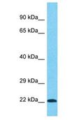 PRPF38B Antibody - PRPF38B antibody Western Blot of HCT15. Antibody dilution: 1 ug/ml.  This image was taken for the unconjugated form of this product. Other forms have not been tested.