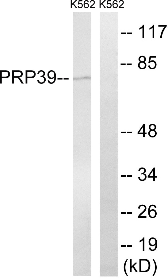 PRPF39 Antibody - Western blot analysis of lysates from K562 cells, using PRPF39 Antibody. The lane on the right is blocked with the synthesized peptide.