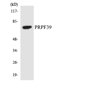 PRPF39 Antibody - Western blot analysis of the lysates from COLO205 cells using PRPF39 antibody.