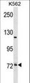 PRPF39 Antibody - PRPF39 Antibody western blot of K562 cell line lysates (35 ug/lane). The PRPF39 antibody detected the PRPF39 protein (arrow).