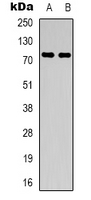 PRPF39 Antibody - Western blot analysis of PRPF39 expression in HeLa (A); K562 (B) whole cell lysates.