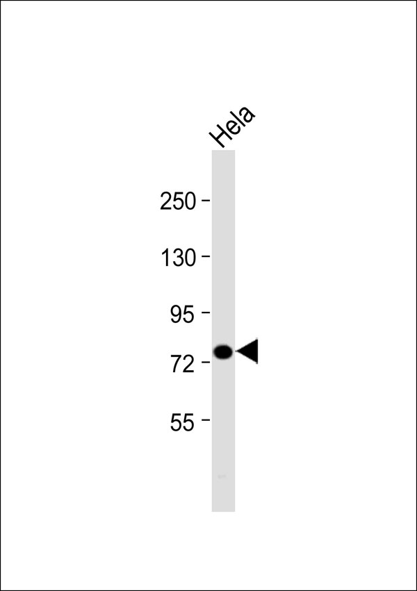 PRPF39 Antibody - Anti-PRPF39 Antibody at 1:1000 dilution + HeLa whole cell lysate Lysates/proteins at 20 ug per lane. Secondary Goat Anti-Rabbit IgG, (H+L), Peroxidase conjugated at 1:10000 dilution. Predicted band size: 78 kDa. Blocking/Dilution buffer: 5% NFDM/TBST.