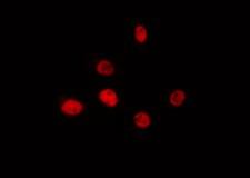 PRPF39 Antibody - Staining HeLa cells by IF/ICC. The samples were fixed with PFA and permeabilized in 0.1% Triton X-100, then blocked in 10% serum for 45 min at 25°C. The primary antibody was diluted at 1:200 and incubated with the sample for 1 hour at 37°C. An Alexa Fluor 594 conjugated goat anti-rabbit IgG (H+L) Ab, diluted at 1/600, was used as the secondary antibody.