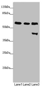 PRPF4 Antibody - Western blot All Lanes: PRPF4 antibody at 2.87 ug/ml Lane 1: Jurkat whole cell lysate Lane 2: Hela whole cell lysate Lane 3: HepG-2 whole cell lysate Secondary Goat polyclonal to rabbit IgG at 1/10000 dilution Predicted band size: 58 kDa Observed band size: 58,45 kDa