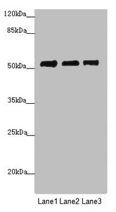 PRPF4 Antibody - Western blot All Lanes: PRPF4 antibody at 3.89 ug/ml Lane 1: Jurkat whole cell lysate Lane 2: Hela whole cell lysate Lane 3: HepG-2 whole cell lysate Secondary Goat polyclonal to rabbit IgG at 1/10000 dilution Predicted band size: 58 kDa Observed band size: 58 kDa