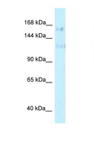 PRPF40A / FNBP3 Antibody - PRPF40A antibody Western blot of HepG2 Cell lysate. Antibody concentration 1 ug/ml.  This image was taken for the unconjugated form of this product. Other forms have not been tested.