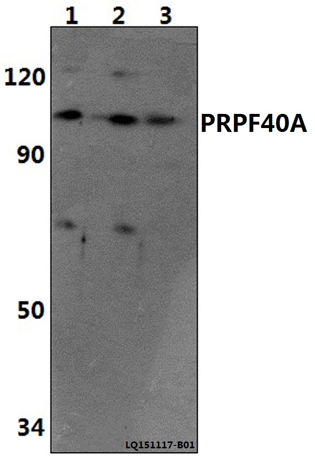 PRPF40A / FNBP3 Antibody - Western blot of PRPF40A polyclonal antibody at 1:500 dilution. Lane 1: HeLa whole cell lysate (40 ug). Lane 2: The Brain tissue lysate of Rat(30 ug). Lane 3: The Brain tissue lysate of Mouse(30 ug).