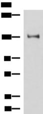 PRPF40A / FNBP3 Antibody - Western blot analysis of Hela cell lysate  using PRPF40A Polyclonal Antibody at dilution of 1:800