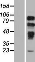 PRPF40B Protein - Western validation with an anti-DDK antibody * L: Control HEK293 lysate R: Over-expression lysate