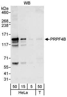 PRPF4B Antibody - Detection of Human PRPF4B by Western Blot. Samples: Whole cell lysate from HeLa (5, 15 and 50 ug) and 293T (T; 50 ug) cells. Antibodies: Affinity purified rabbit anti-PRPF4B antibody used for WB at 0.04 ug/ml. Detection: Chemiluminescence with an exposure time of 30 seconds.