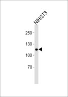 PRPF6 / TOM Antibody - Western blot of lysate from mouse NIH/3T3 cell line with PRPF6 Antibody. Antibody was diluted at 1:1000. A goat anti-rabbit IgG H&L (HRP) at 1:5000 dilution was used as the secondary antibody. Lysate at 35 ug.