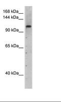 PRPF6 / TOM Antibody - Transfected 293T Cell Lysate.  This image was taken for the unconjugated form of this product. Other forms have not been tested.