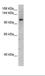PRPF6 / TOM Antibody - Transfected 293T Cell Lysate.  This image was taken for the unconjugated form of this product. Other forms have not been tested.
