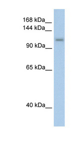 PRPF6 / TOM Antibody - PRPF6 antibody ARP40734_T100-NP_036601-PRPF6(PRP6 pre-mRNA processing factor 6 homolog (S. cerevisiae)) Antibody Western blot of Transfected 293T cell lysate.  This image was taken for the unconjugated form of this product. Other forms have not been tested.