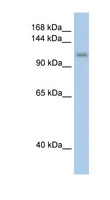 PRPF6 / TOM Antibody - PRPF6 antibody ARP40734_T100-NP_036601-PRPF6(PRP6 pre-mRNA processing factor 6 homolog (S. cerevisiae)) Antibody Western blot of Transfected 293T cell lysate.  This image was taken for the unconjugated form of this product. Other forms have not been tested.