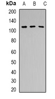 PRPF6 / TOM Antibody - Western blot analysis of PRPF6 expression in HeLa (A); HEK293T (B); mouse brain (C) whole cell lysates.