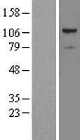 PRPF6 / TOM Protein - Western validation with an anti-DDK antibody * L: Control HEK293 lysate R: Over-expression lysate