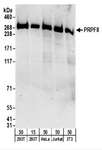 PRPF8 Antibody - Detection of Human and Mouse PRPF8 by Western Blot. Samples: Whole cell lysate from 293T (15 and 50 ug), HeLa (50 ug), Jurkat (50 ug), and mouse NIH3T3 (50 ug) cells. Antibodies: Affinity purified rabbit anti-PRPF8 antibody used for WB at 0.1 ug/ml. Detection: Chemiluminescence with an exposure time of 3 minutes.