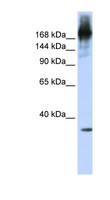 PRPF8 Antibody - PRPF8 antibody Western blot of Jurkat lysate. This image was taken for the unconjugated form of this product. Other forms have not been tested.
