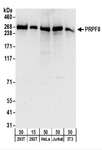 PRPF8 Antibody - Detection of Human and Mouse PRPF8 by Western Blot. Samples: Whole cell lysate from 293T (15 and 50 ug), HeLa (50 ug), Jurkat (50 ug), and mouse NIH3T3 (50 ug) cells. Antibodies: Affinity purified rabbit anti-PRPF8 antibody used for WB at 0.1 ug/ml. Detection: Chemiluminescence with an exposure time of 30 seconds.