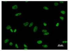 PRPF8 Antibody - Immunofluorescent staining using PRPF8 antibody. Immunostaining analysis in HeLa cells. HeLa cells were fixed with 4% paraformaldehyde and permeabilized with 0.01% Triton-X100 in PBS. The cells were immunostained with anti-PRPF8 antibody.