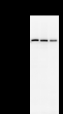 PRPF8 Antibody - Detection of PRPF8 by Western blot. Samples: Whole cell lysate from human HEK293 (H, 25 ug) , mouse NIH3T3 (M, 25 ug) and rat F2408 (R, 25 ug) cells. Predicted molecular weight: 273 kDa