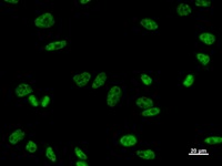 PRPF8 Antibody - Immunostaining analysis in HeLa cells. HeLa cells were fixed with 4% paraformaldehyde and permeabilized with 0.1% Triton X-100 in PBS. The cells were immunostained with anti-PRPF8 mAb.
