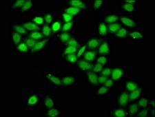 PRPF8 Antibody - Immunofluorescence staining of Hela cells at a dilution of 1:166, counter-stained with DAPI. The cells were fixed in 4% formaldehyde, permeabilized using 0.2% Triton X-100 and blocked in 10% normal Goat Serum. The cells were then incubated with the antibody overnight at 4 °C.The secondary antibody was Alexa Fluor 488-congugated AffiniPure Goat Anti-Rabbit IgG (H+L) .