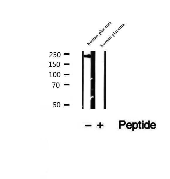 PRPF8 Antibody - Western blot analysis of extracts of human placenta tissue using PRPF8 antibody.